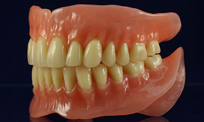 BPS DENTURE- SINGLE ARCH