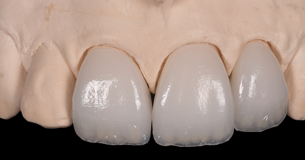 ZIRCONIA PREMIUM