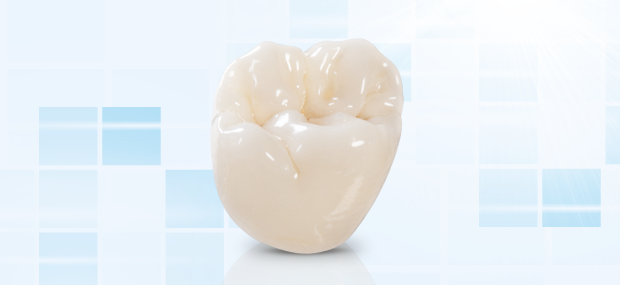 CEMENT RETAINED ZIRCONIA CROWN