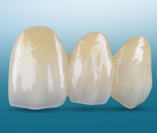 Zirconia Elite