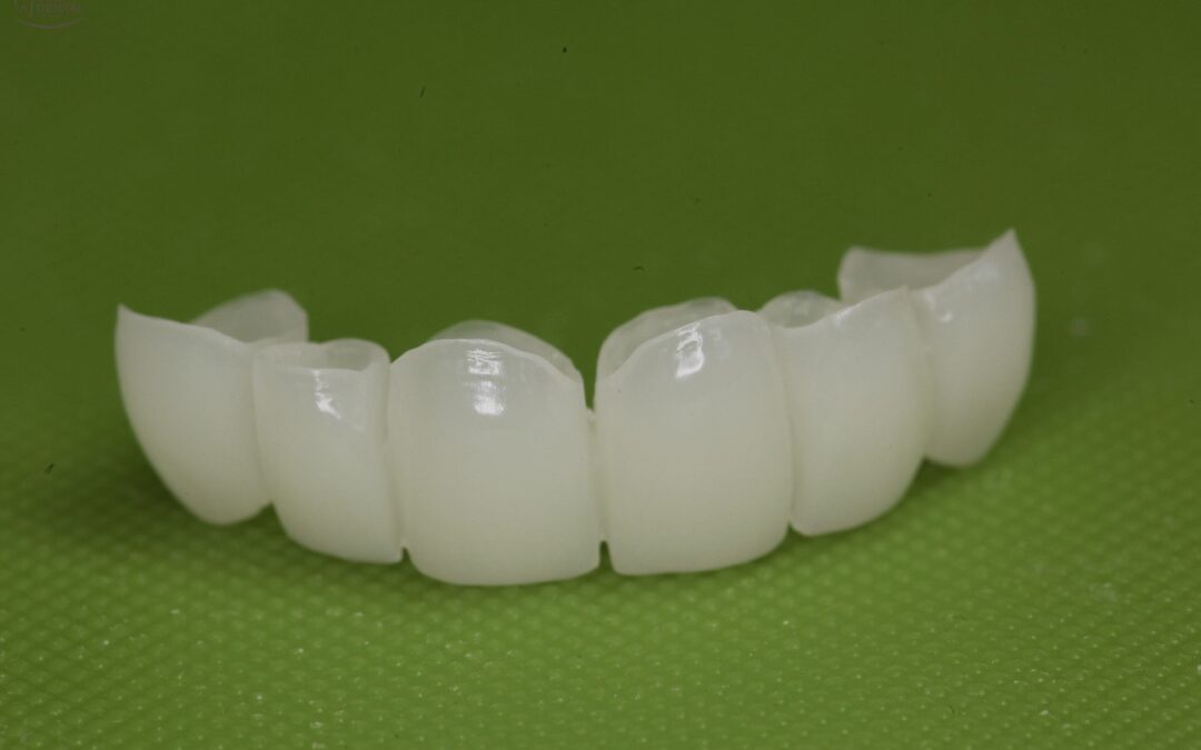 PMMA TEMP CROWNS