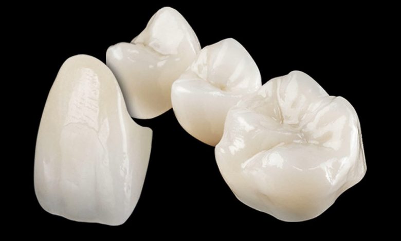 Zirconia Classic